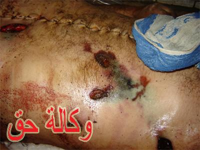 الشيخ أبو بكر النابلسي أنموذجا لاجتثاث الرافضة الدموي